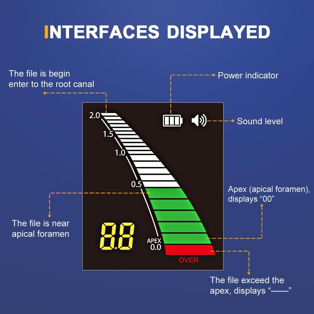 Dental Apex Locator