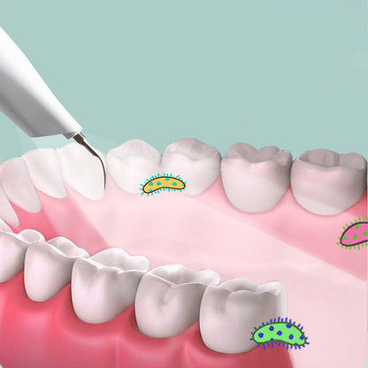 HexoSmile™ Ultrasonic Dental Cleaner for Tartar Removal & Teeth Whitening