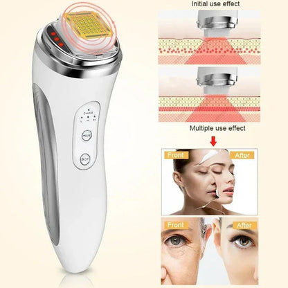 HexoLift™ – Dot Matrix Facial Lifting & Skin Rejuvenation Device