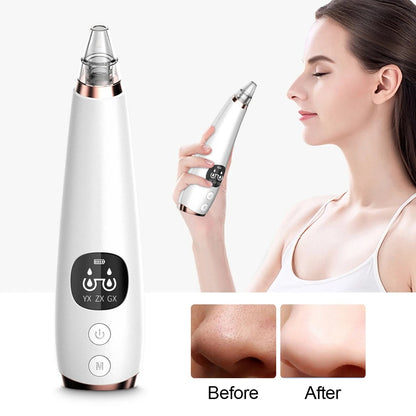 HexoClear™ – Electric Pore Vacuum & Blackhead Remover