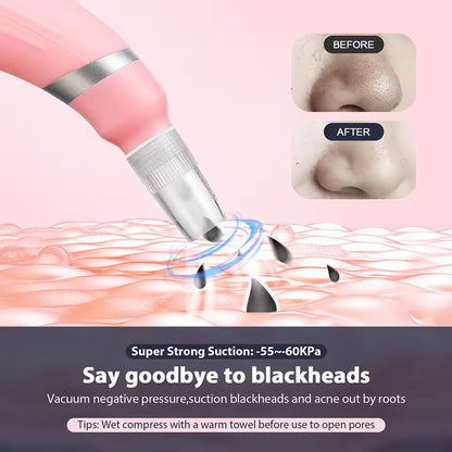 HexoGlow™ – Microdermabrasion Pore Cleaner for Radiant Skin