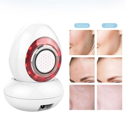 HexoRadiance™ – LED & Radio Frequency Skin Tightener