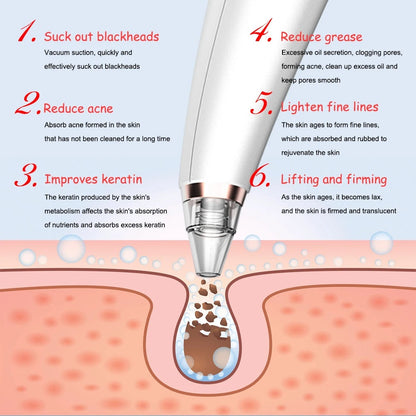 HexoClear™ – Electric Pore Vacuum & Blackhead Remover