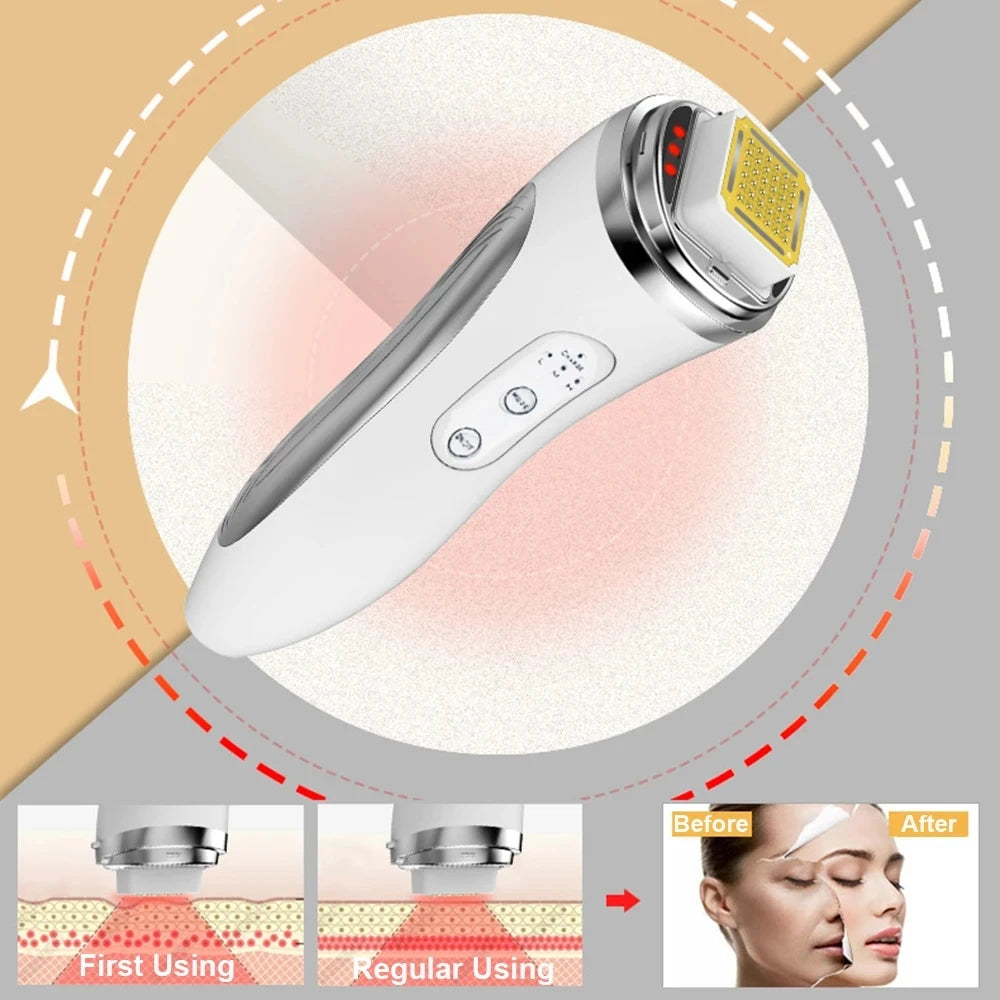 HexoLift™ – Dot Matrix Facial Lifting & Skin Rejuvenation Device