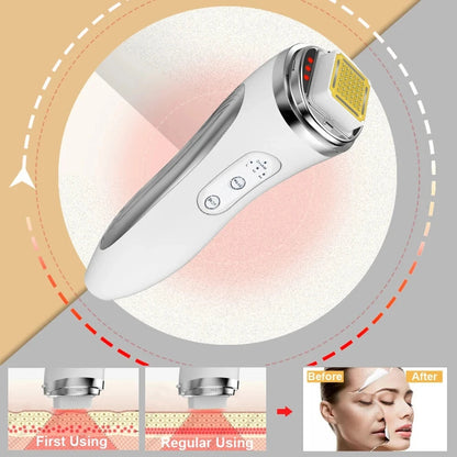 HexoLift™ – Dot Matrix Facial Lifting & Skin Rejuvenation Device