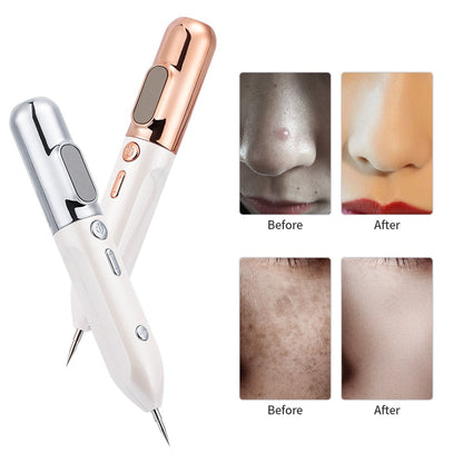 HexoPen™️ Mole & Skin Tag Removal Plasma Pen