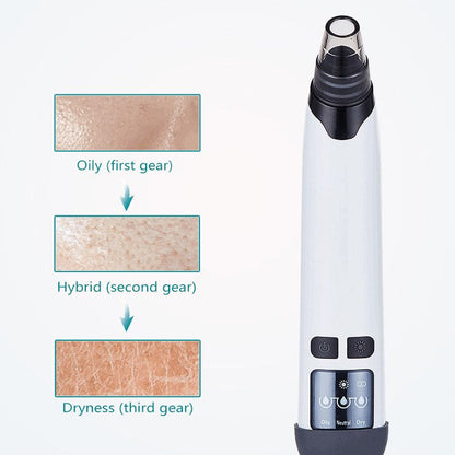 HexoSkin™ – Blackhead Remover with Heat & Adjustable Suction