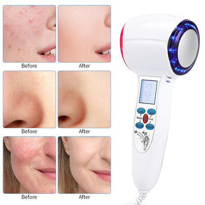 HexoCryo™ At-Home Facial Cryotherapy Device