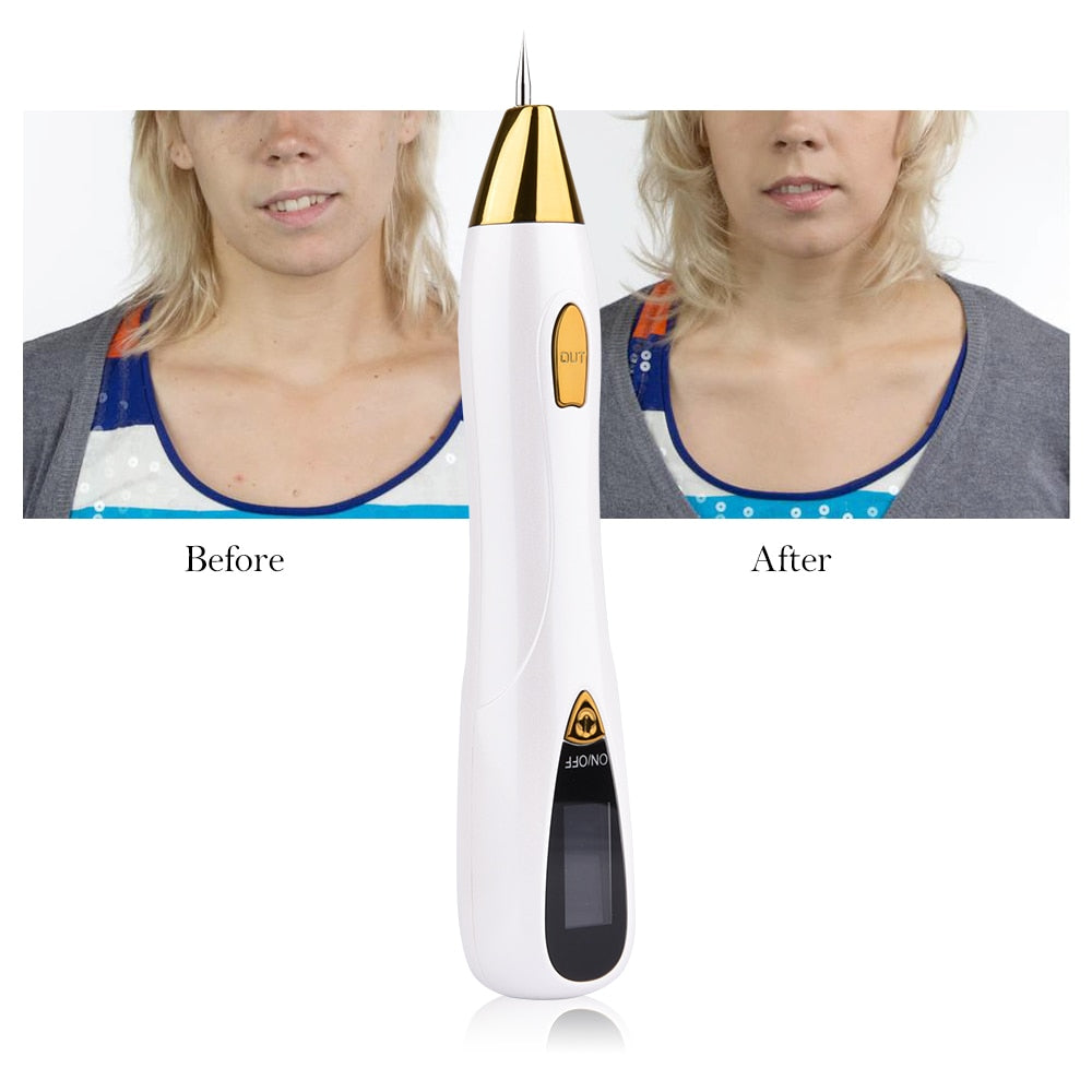 HexoPlasma™️ Mole Removal Pen