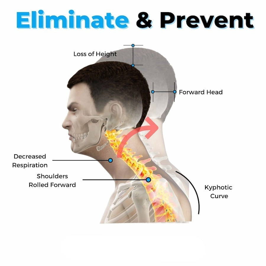 HexoNeck™ Cervical Neck Pain Relief Stretcher