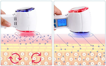 HexoCryo™ At-Home Facial Cryotherapy Device
