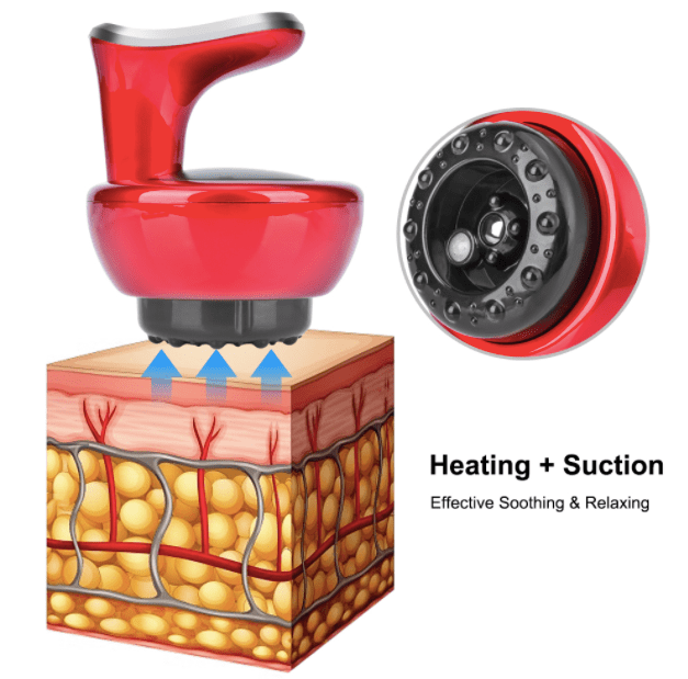 HexoMassage™ Electric Cupping & Scraping Machine