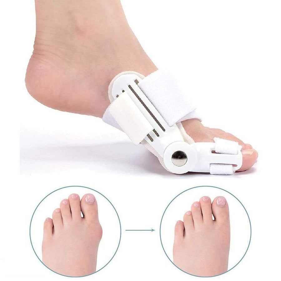 HexoBunion™ Orthopedic Bunion Corrector (1 Pair)