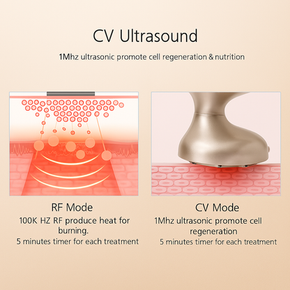 HexoTone™ Ultrasonic EMS & RF Body Slimming Massager with LED Photon Therapy